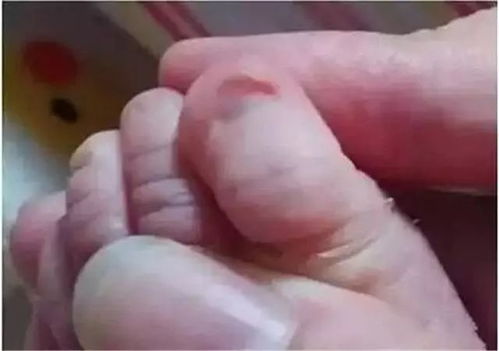 宝宝的指甲怎么剪以后好看