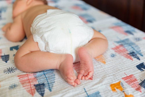 新生儿尿布疹的预防治疗方法