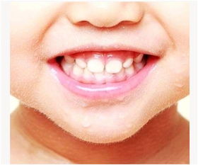 宝宝牙齿护理知识培训内容