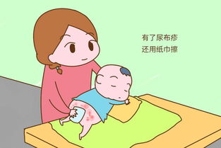 给婴儿更换尿布时应注意
